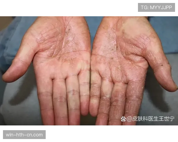 手部接触判定标准详解：怎样才算犯规与普通接触区别